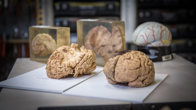 Science in Progress: Dissecting the Human Brain
