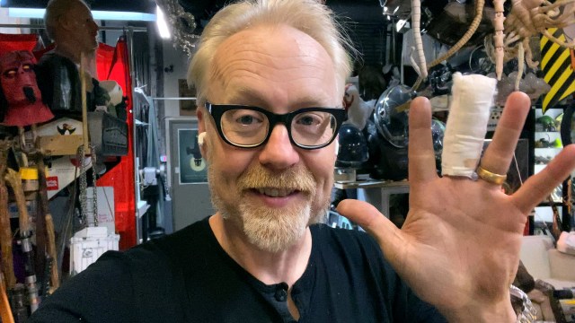 Adam Savage Explains His Scary Hand Injury!